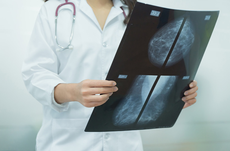 AI and Medical Imaging: Transforming Diagnosis & Care